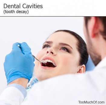 dental cavities